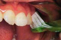 牙刷與牙齒呈 45~60度角,並輕壓向牙齒，使刷毛的側邊也與牙齒接觸，但刷毛不可被牙齒分岔